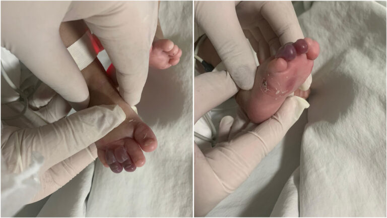 Mãe denuncia possível negligência médica no HMM após parada cardíaca de bebê de 3 meses
